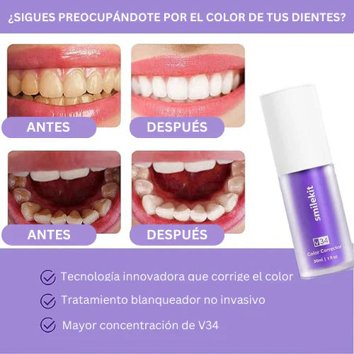 Blanqueador Dental V34™ -  ¡PAGUE 1 Y LLEVE 2 SOLO HOY!